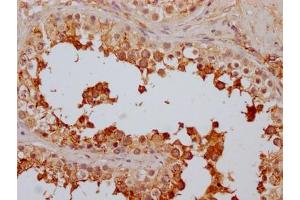 IHC image of ABIN7127479 diluted at 1:100 and staining in paraffin-embedded human testis tissue performed on a Leica BondTM system.