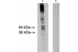 Western blot analysis using LAG1 longevity assurance homolog 2 . (Ceramide Synthase 2 anticorps)