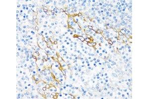 Immunohistochemistry of paraffin-embedded Human tonsil using PLA2G4C Polyclonal Antibody at dilution of 1:100 (40x lens). (PLA2G4C anticorps)
