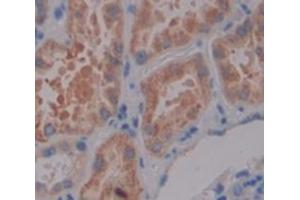 IHC-P analysis of Human Tissue, with DAB staining. (MPP3 anticorps  (AA 627-802))