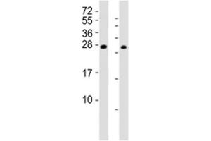 Western blot testing of RHOXF1 antibody at 1:2000 (RHOXF1 anticorps  (AA 85-120))