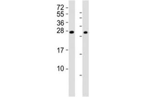 Western blot testing of RHOXF1 antibody at 1:2000 (RHOXF1 anticorps  (AA 85-120))