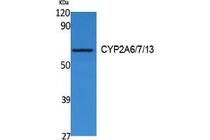 Western Blotting (WB) image for anti-CYP2A6/7/13 (Internal Region) antibody (ABIN3178124) (CYP2A6/7/13 (Internal Region) anticorps)