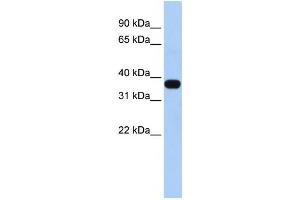 Western Blotting (WB) image for anti-Mitochondrial E3 Ubiquitin Protein Ligase 1 (MUL1) antibody (ABIN2458733) (MUL1 anticorps)