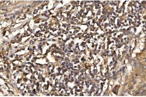 IHC analysis of ASK1/MAP3K5 using anti-ASK1/MAP3K5 antibody (ABIN7600304). (ASK1 anticorps  (AA 178-1112))
