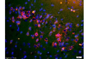 Formalin-fixed and paraffin embedded rat brain carcinoma labeled with Rabbit Anti-ApoA4 Polyclonal Antibody, Unconjugated (ABIN749153) at 1:200 followed by secondary antibody was Goat Anti-Rabbit IgG, Cy3 conjugated used at 1:200 dilution for 40 minutes at 37°C.