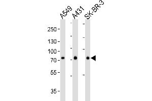 Western blot analysis of lysates from A549, A431, SK-BR-3 cell line (from left to right), using CN2 Antibody (ABIN6244177 and ABIN6577076). (Calpain 2 anticorps  (AA 1-400))