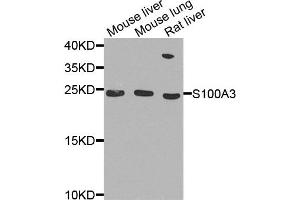 Western blot analysis of extract of various cells, using S100A3 antibody. (S100A3 anticorps)