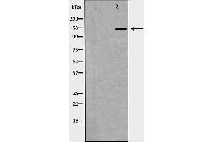 Western blot analysis of Jurkat whole cell lysates, using PTPRC Antibody.