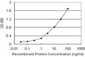 FABP1 (Human) Matched Antibody Pair