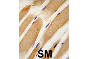 Formalin-fixed and paraffin-embedded human skeletal muscle tissue reacted with ACTB/ACTC antibody , which was peroxidase-conjugated to the secondary antibody, followed by DAB staining.