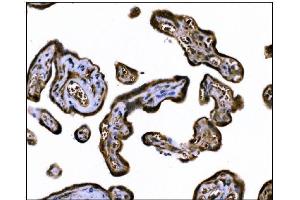 IHC analysis of TGFBR2 using anti-TGFBR2 antibody (ABIN7603157).
