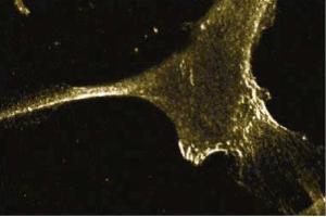 Immunofluorescent staining of Human Fibroblast cells with anti-E-Cadherin antibody. (E-cadherin anticorps  (AA 735-883))