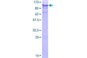 Image no. 1 for URI1, Prefoldin-Like Chaperone (URI1) (AA 1-495) protein (GST tag) (ABIN1347260)