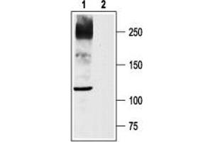 Western blot analysis of rat DRG lysates: - 1. (Nav1.8 anticorps  (C-Term, Intracellular))