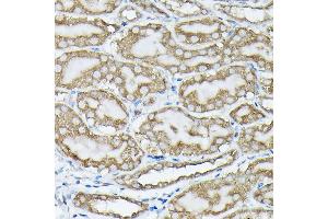 Immunohistochemistry of paraffin-embedded mouse kidney using Phospho-KRAS-S89 Rabbit pAb (ABIN7267530) at dilution of 1:100 (40x lens).