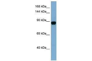 CASD1 antibody used at 1 ug/ml to detect target protein. (CASD1 anticorps  (N-Term))