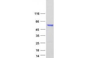 Validation with Western Blot