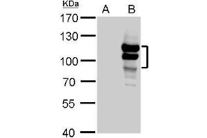 WB Image L3MBTL antibody detects L3MBTL protein by Western blot analysis. (L3MBTL1 anticorps  (Center))