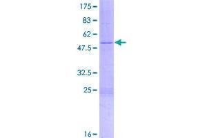 Image no. 1 for Ribosomal Protein L10 (RPL10) (AA 1-214) protein (GST tag) (ABIN7595964)