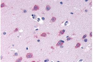Anti-GPRC6A antibody  ABIN1048920 IHC staining of human brain, neurons and glia. (GPRC6A anticorps  (N-Term))