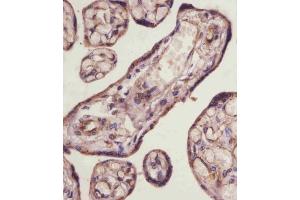 (ABIN6243319 and ABIN6578857) staining TGFBR3 in human placenta tissue sections by Immunohistochemistry (IHC-P - paraformaldehyde-fixed, paraffin-embedded sections).
