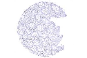 colon descendens mucosa