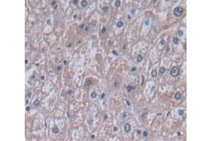 IHC-P analysis of Human Tissue, with DAB staining. (PIGR anticorps  (AA 19-120))