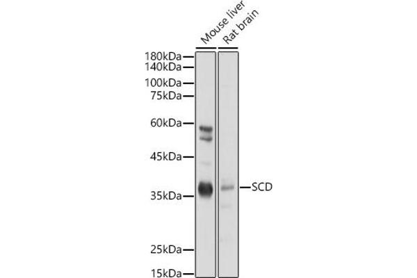 SCD 抗体  (C-Term)