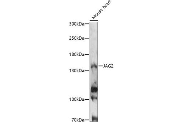 JAG2 抗体  (AA 24-200)
