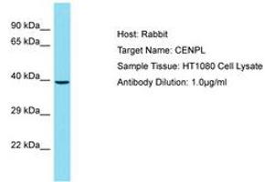 Image no. 1 for anti-Centromere Protein L (CENPL) (AA 121-170) antibody (ABIN6750825) (CENPL anticorps  (AA 121-170))
