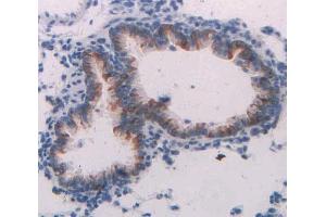 IHC-P analysis of lung tissue, with DAB staining. (Neuregulin 1 anticorps  (AA 328-486))