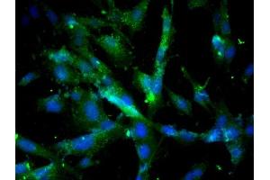 Image provided by One World Lab validation program. (Cathepsin D anticorps  (AA 101-200))