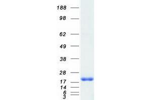 Validation with Western Blot