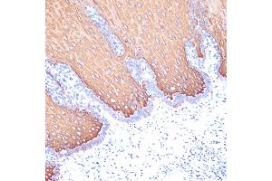 Immunohistochemistry of paraffin-embedded human esophageal using Cytokeratin 6 (KRT6) (KRT6) Rabbit mAb (ABIN7268104) at dilution of 1:100 (40x lens). (Keratin 6C anticorps)