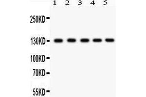 Western Blotting (WB) image for anti-Death-Domain Associated Protein (DAXX) (AA 56-345) antibody (ABIN3043822) (DAXX anticorps  (AA 56-345))