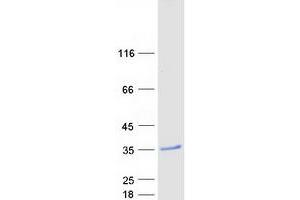 Validation with Western Blot