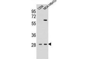 Western blot analysis in CEM,MDA-MB453 cell line lysates (35ug/lane) using Interleukin-12 beta/IL12B  Antibody (C-term). (IL12B anticorps  (C-Term))