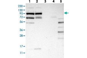 Western blot analysis of Lane 1: RT-4, Lane 2: U-251 MG, Lane 3: Human Plasma, Lane 4: Liver, Lane 5: Tonsil with SLFN5 polyclonal antibody  at 1:250-1:500 dilution. (SLFN5 anticorps)