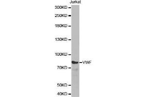 Western blot analysis of extracts of Jurkat cell line, using VWF antibody. (VWF anticorps  (AA 50-150))