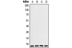 Western blot analysis of COX7A2L expression in Jurkat (A), HeLa (B), Raw264. (COX7A2L anticorps  (Center))