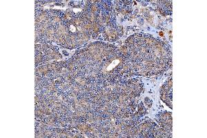 IHC analysis of TTC7B using anti-TTC7B antibody (ABIN7601050). (TTC7B anticorps  (AA 275-730))