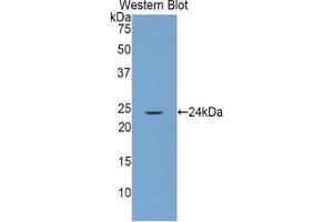 Western blot analysis of the recombinant protein. (GRIP1 anticorps  (AA 79-268))