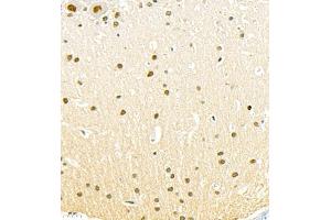 Immunohistochemistry of paraffin embedded rat epencephalon using SUV39H1 (ABIN7075770) at dilution of 1:500 (400x lens) (SUV39H1 anticorps)