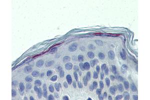 Anti-ERCC8 antibody IHC of human skin. (ERCC8 anticorps  (AA 106-300))