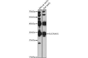 Western blot analysis of extracts of various cell lines, using SLC25 antibody (ABIN7270427) at 1:1000 dilution. (SLC25A31 anticorps  (AA 100-200))