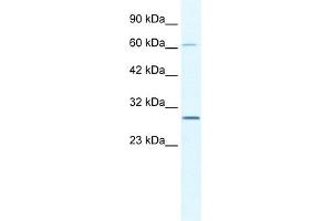 WB Suggested Anti-PAntibody   Titration: 2. (PARP11 anticorps  (N-Term))