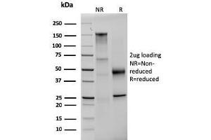 SDS-PAGE Analysis Purified Prolactin Mouse Monoclonal Antibody (PRL/2642). (Prolactin anticorps  (AA 63-201))