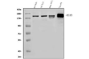 Western blot analysis of NCAM1 using anti-NCAM1 antibody (ABIN7602512).