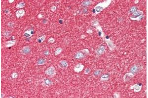Human Brain, Cortex (formalin-fixed, paraffin-embedded) stained with SNAP25 antibody ABIN337119 at 2. (SNAP25 anticorps  (AA 193-206))